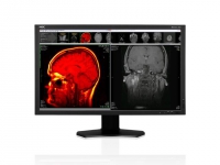 NEC MDview 243 NEC MDview 243